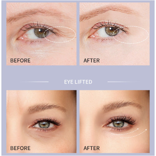 eye care before and after comparison pictures